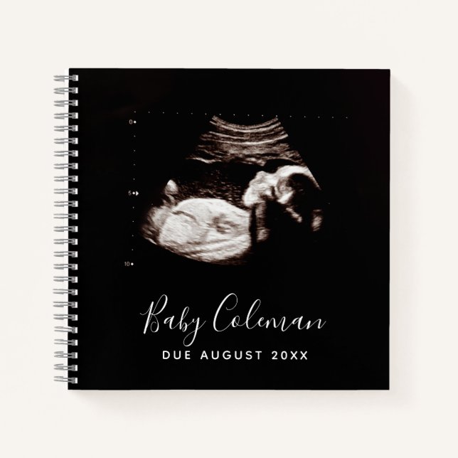 Baby Sonogram Personalised Memory Pregnancy Book (Front)