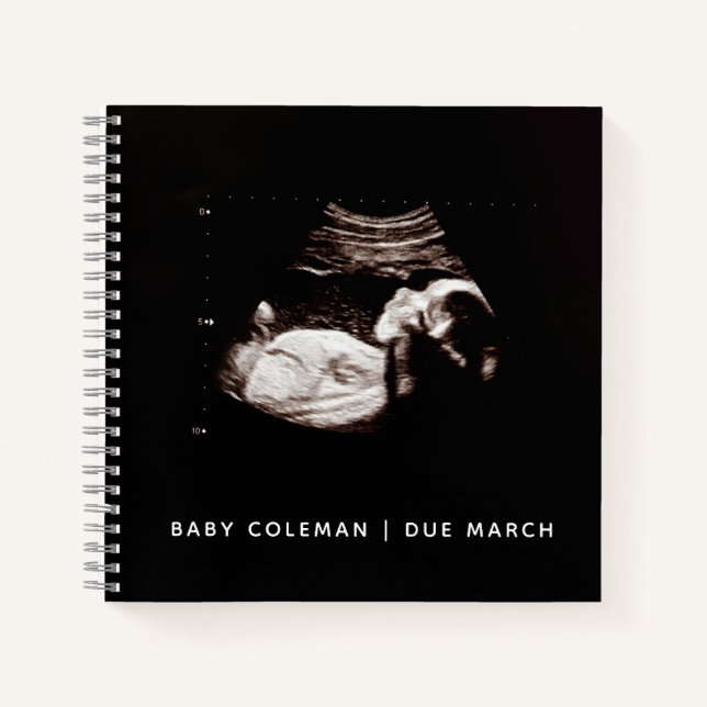 Baby Sonogram Personalised Memory Pregnancy Book (Front)