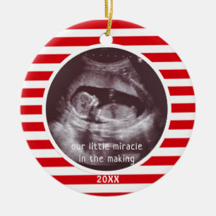 Baby Ultrasound Photo Red White Stripe Christmas Ceramic Ornament