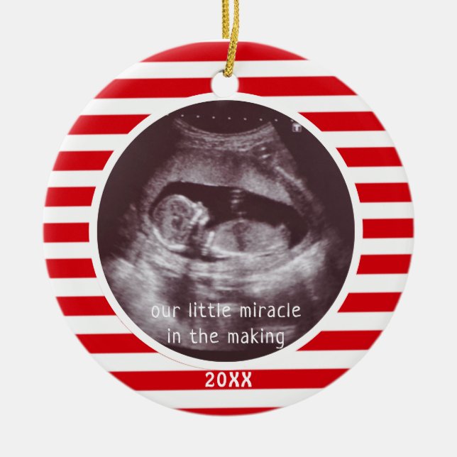 Baby Ultrasound Photo Red White Stripe Christmas Ceramic Ornament (Front)