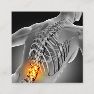 Back Pain Photo Graphic Square Chiropractic Business Card