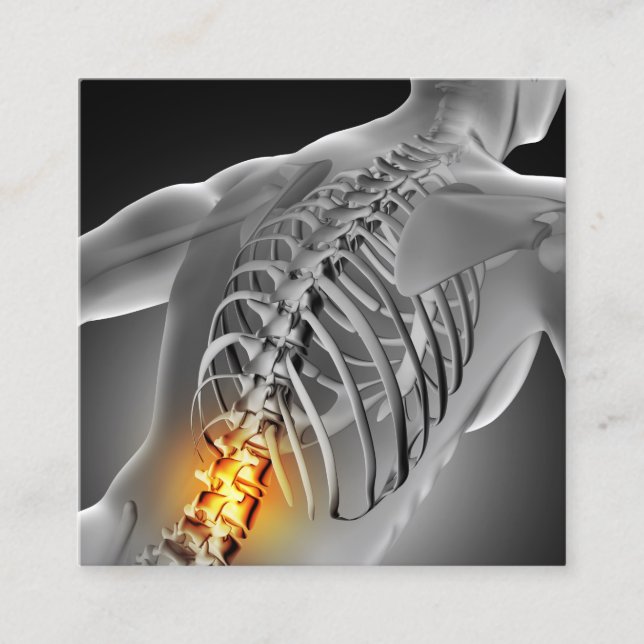 Back Pain Photo Graphic Square Chiropractic Business Card (Front)