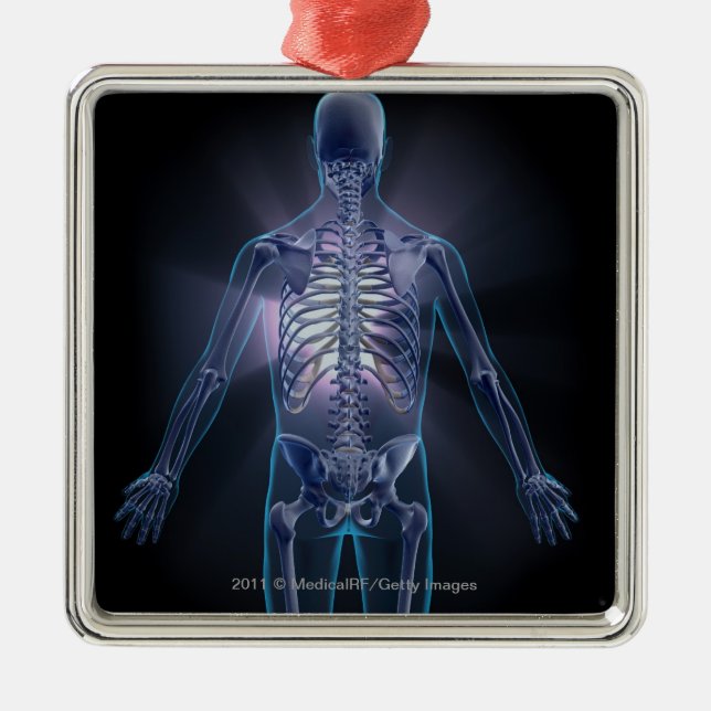 Back view of a human skeleton metal tree decoration (Front)