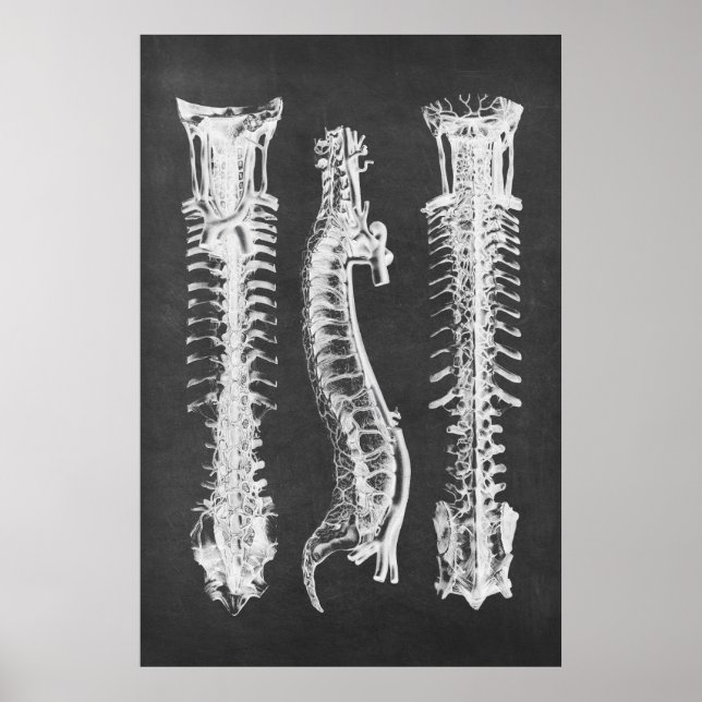 Backbone Vertebrae Anatomy Print no.2 (Front)