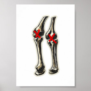 Bad Knees – Funny Skeleton Knee Illustration Poster