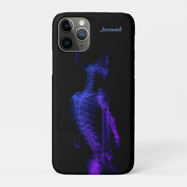 Beautiful Half Body X-ray Case-Mate iPhone Case (Back)