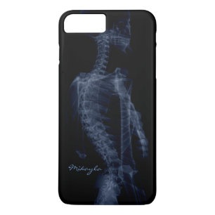 Beautiful, Personalised Body X-Ray iPhone 8 Plus/7 Plus Case