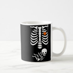 Beer Belly & Baby Skeleton Pregnancy Couples H Coffee Mug
