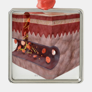 Blood Clot Formation Metal Tree Decoration