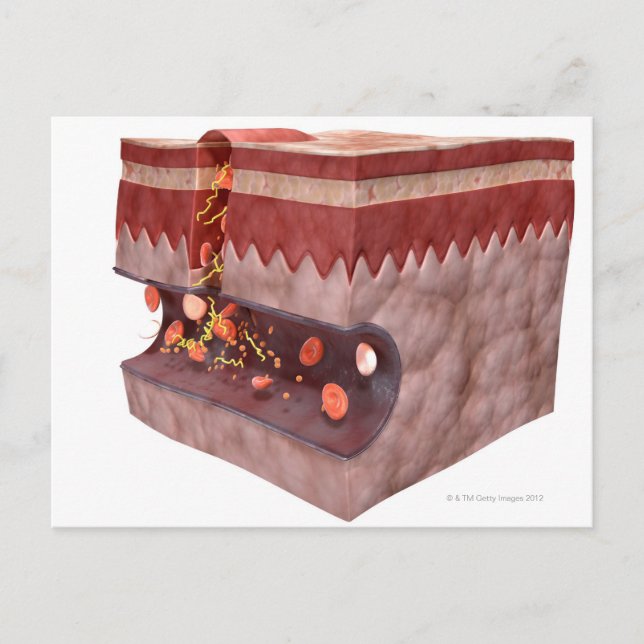 Blood Clot Formation Postcard (Front)