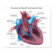Blood flow through the heart poster