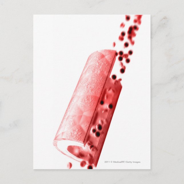 Blood flowing through an artery postcard (Front)