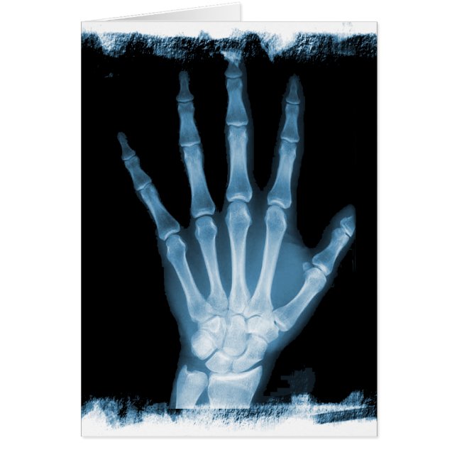Blue X-ray Skeleton Hand (Front)