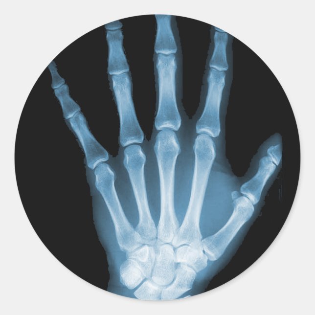 Blue X-ray Skeleton Hand Classic Round Sticker (Front)