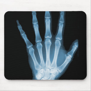 Blue X-ray Skeleton Hand Mouse Pad
