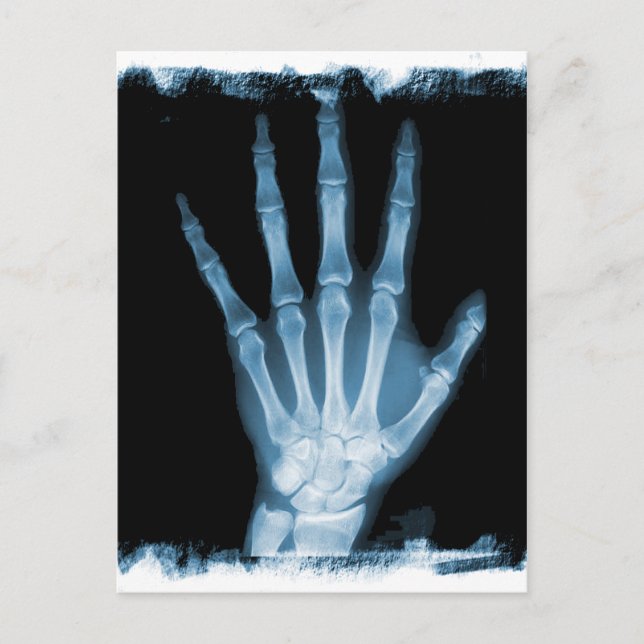 Blue X-ray Skeleton Hand Postcard (Front)