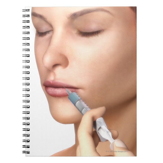 Botox Injections Notebook (Front)