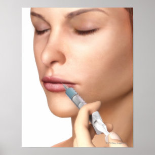 Botox Injections Poster