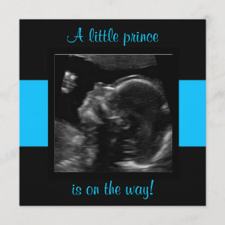 Boy Baby Customised Ultrasound Photo Template