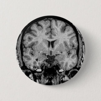 Brain MRI, coronal slice 6 Cm Round Badge