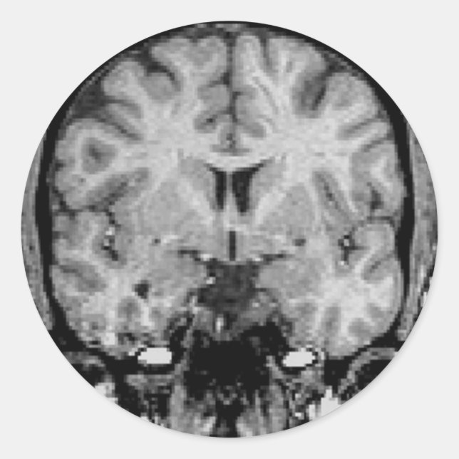 Brain MRI, coronal slice Classic Round Sticker (Front)