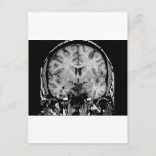 Brain MRI, coronal slice Postcard