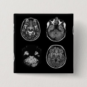 Brain MRI scan 15 Cm Square Badge