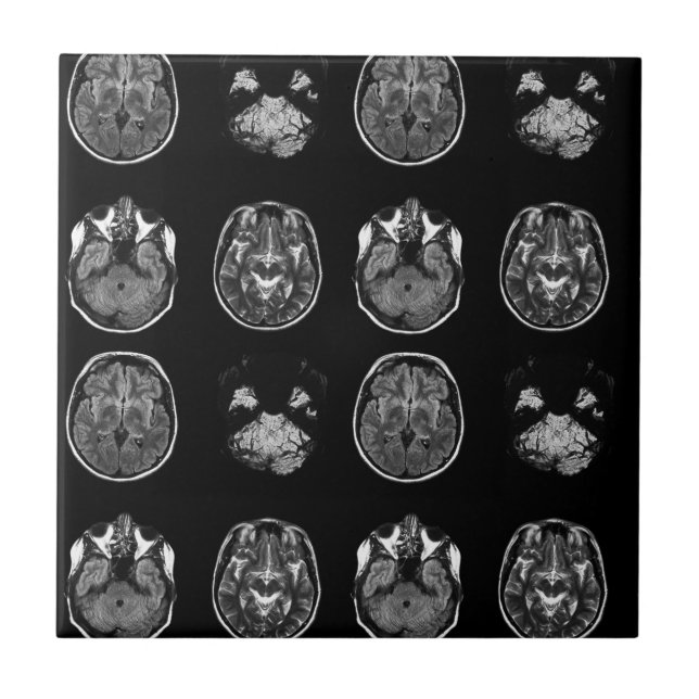 Brain MRI scan Ceramic Tile (Front)