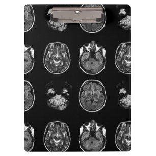 Brain MRI scan Clipboard