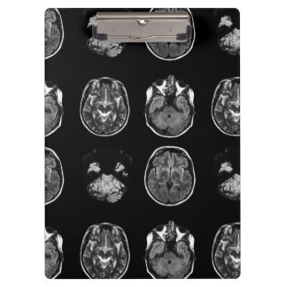 Brain MRI scan Clipboard