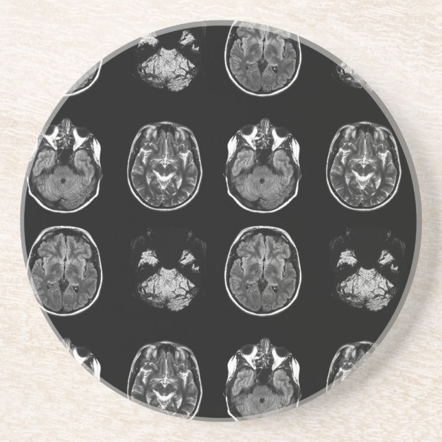 Brain MRI scan Coaster (Front)