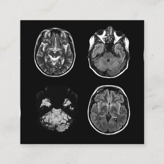 Brain MRI scan Enclosure Card (Front)