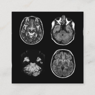 Brain MRI scan Enclosure Card