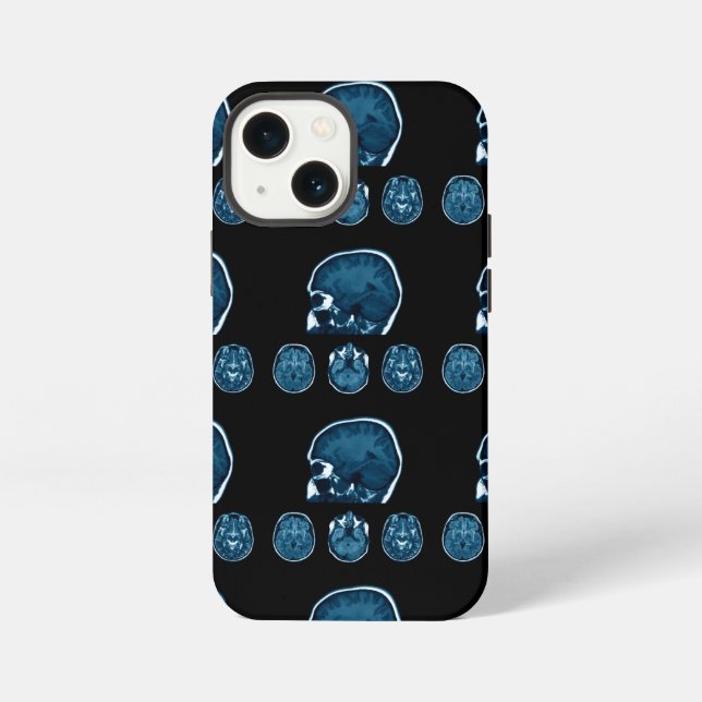 Brain Mri scan iPhone Case (Back)