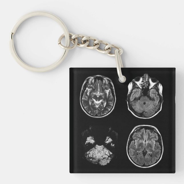 Brain MRI scan Key Ring (Front)