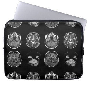 Brain MRI scan Laptop Sleeve