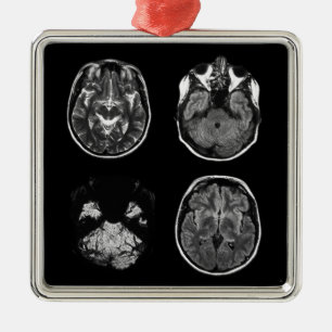 Brain MRI scan Metal Ornament