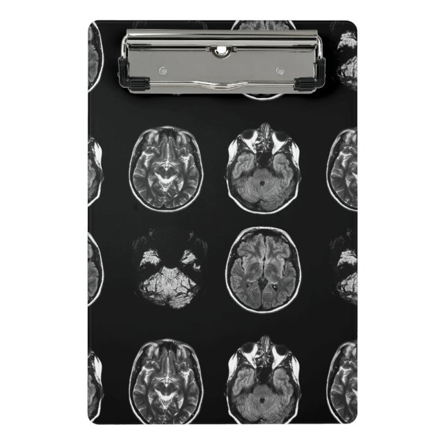 Brain MRI scan Mini Clipboard (Front)