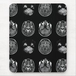 Brain MRI scan Mouse Pad