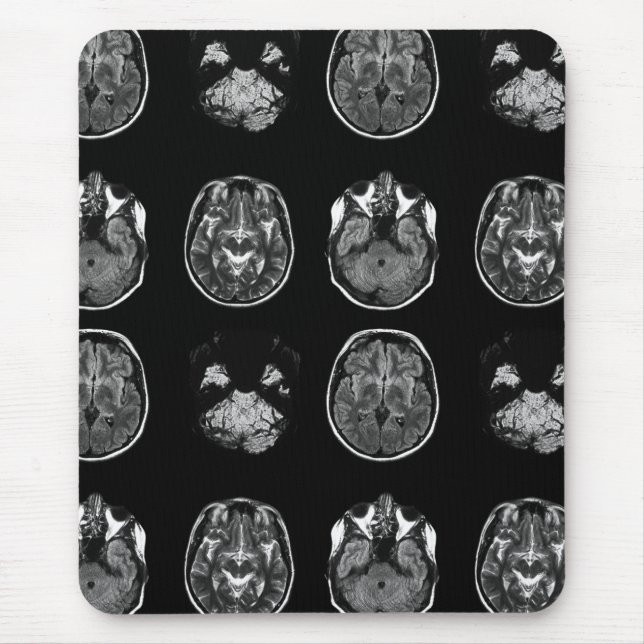 Brain MRI scan Mouse Pad (Front)