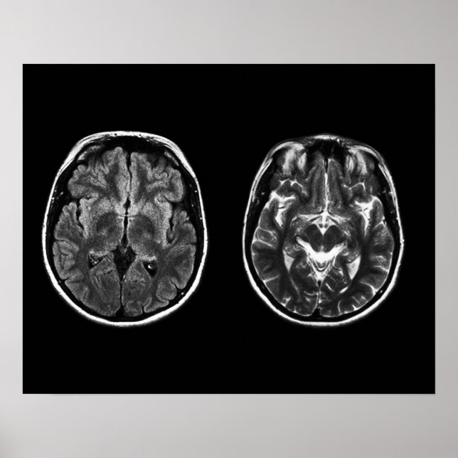 Brain mri scan poster (Front)