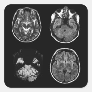 Brain MRI scan Square Sticker