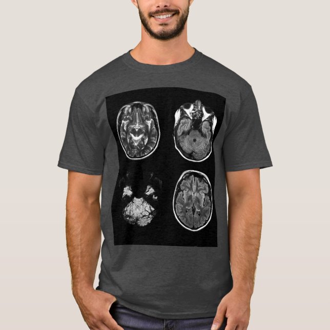 Brain MRI scan T-Shirt (Front)