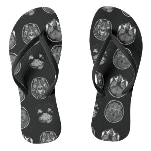 Brain MRI scan Thongs