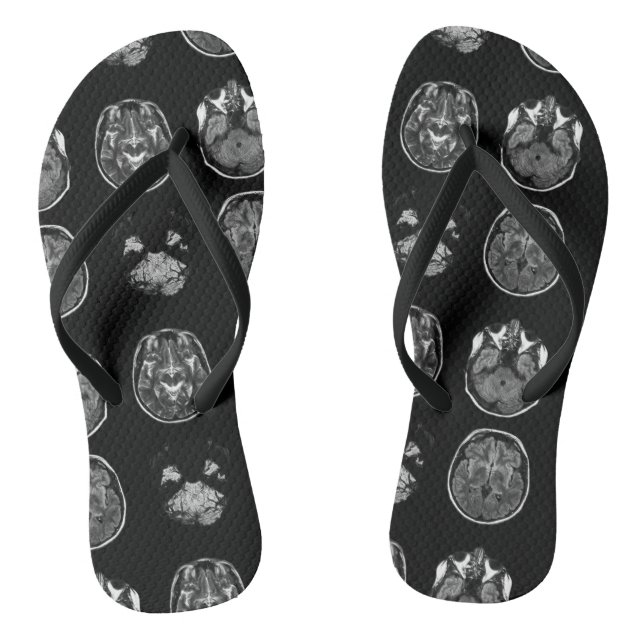 Brain MRI scan Thongs (Footbed)