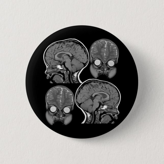 BRAINS! (MRI) 6 CM ROUND BADGE (Front)