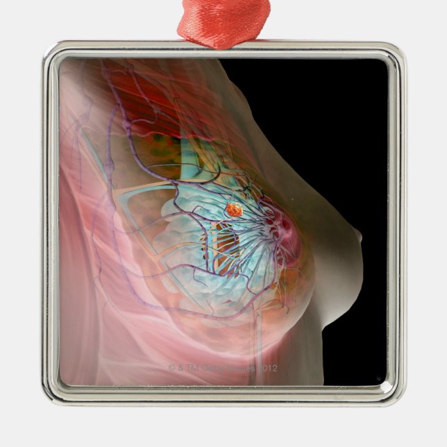 Breast Cancer Metal Ornament (Front)