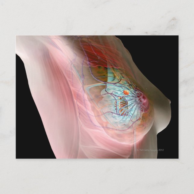 Breast Cancer Postcard (Front)
