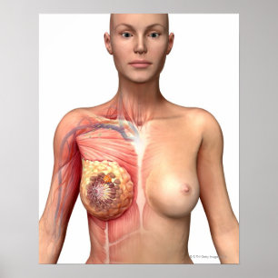 Breast cancer poster