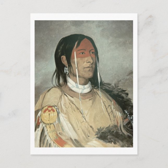 Broken Arm, 1831 (oil on canvas) Postcard (Front)